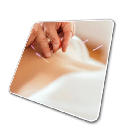 Akupunktur Horn-Bad Meinberg